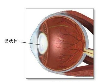 白内障手术后要多长时间才能恢复视力