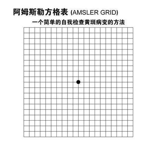 黄斑变性的自我检查方法