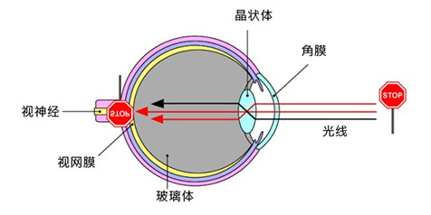 人人都会得白内障吗？有了白内障该怎么办？