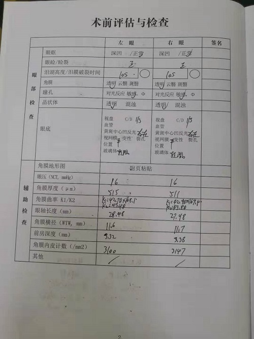 近视手术分享