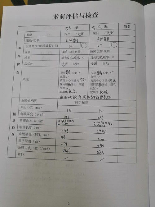 ICL晶体植入分享