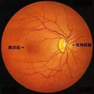 吸烟会增加患老年性黄斑变性的风险吗？