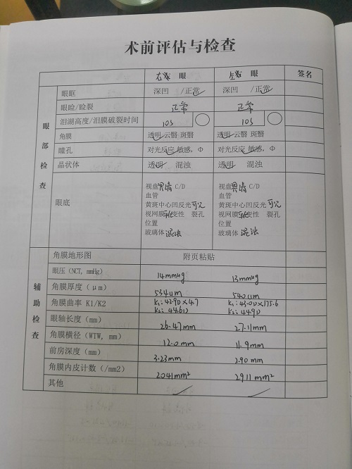 ICL晶体植入分享