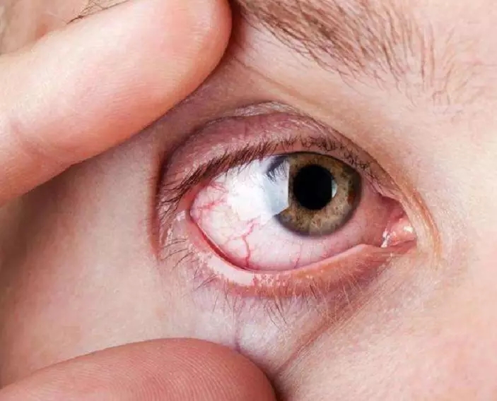 疫情期间，父母眼睛不适该不该去医院？