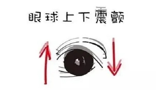 眼睛总是晃个不停是眼球震颤吗？