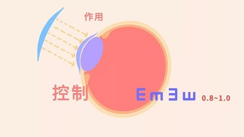 不同年龄段近视矫正手段一样吗？