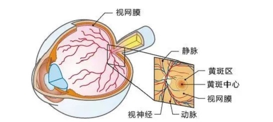 什么是老年性黄斑变性？