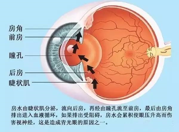 原发性闭角型青光眼早期症状,高眼压