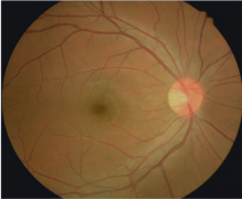 【健康科普】9个常见眼科小知识，值得收藏