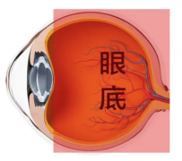 激光治疗眼底病：挽救视