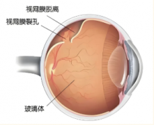 为啥？每次眼科检查都要